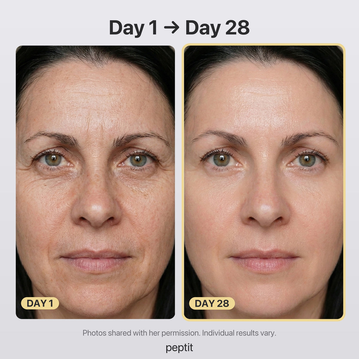 Before and after, Day 1 to Day 28: face photos shared with her permission