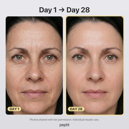 Before and after, Day 1 to Day 28: face photos shared with her permission