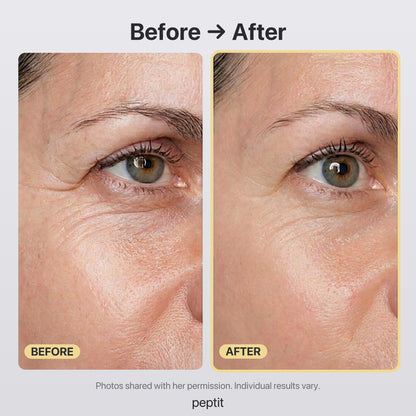 Before and after of the eye area, photos shared with her permission